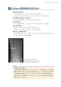 足の外科 NIKIメソッドによる治療戦略 足の外科 NIKIメソッドによる治療戦略 Amazon.co.jp: 誰も教えてくれ